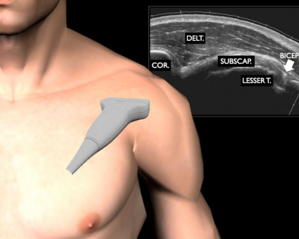 Muskuloskeletální ultrazvuk – základní dovednosti při ultrazvukovém vyšetření ramenního kloubu - 21.11.2019 Muskuloskeletální ultrazvuk – základní dovednosti při ultrazvukovém vyšetření ramenního kloubu - 21.11.2019