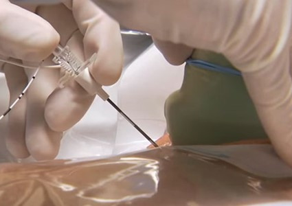 V. základní cadaver kurz ultrazvukem navigovaných intervencí v algeziologii: 18.-19. června 2026