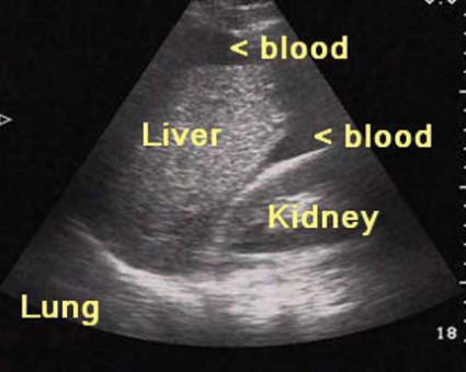 Urgentní medicína