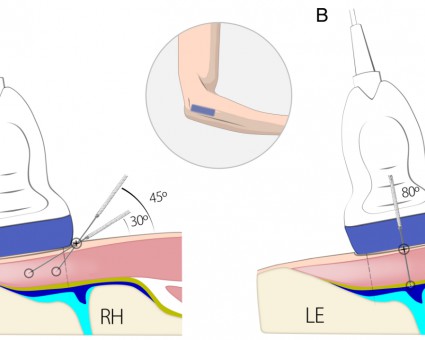 PDF: Musculoskeletal Ultrasound Technical Guidelines